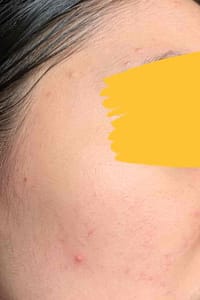 results using tiam b3 niacinamide serum for 3 weeks