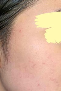 results using tiam b3 niacinamide serum for 10 weeks